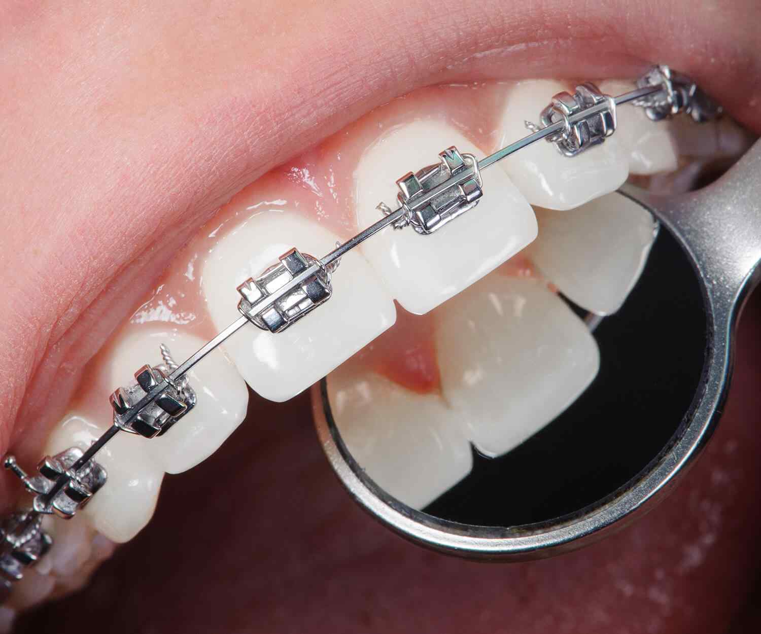 https://rinamed.ma/wp-content/uploads/2021/10/card_image_home_03-03.jpg